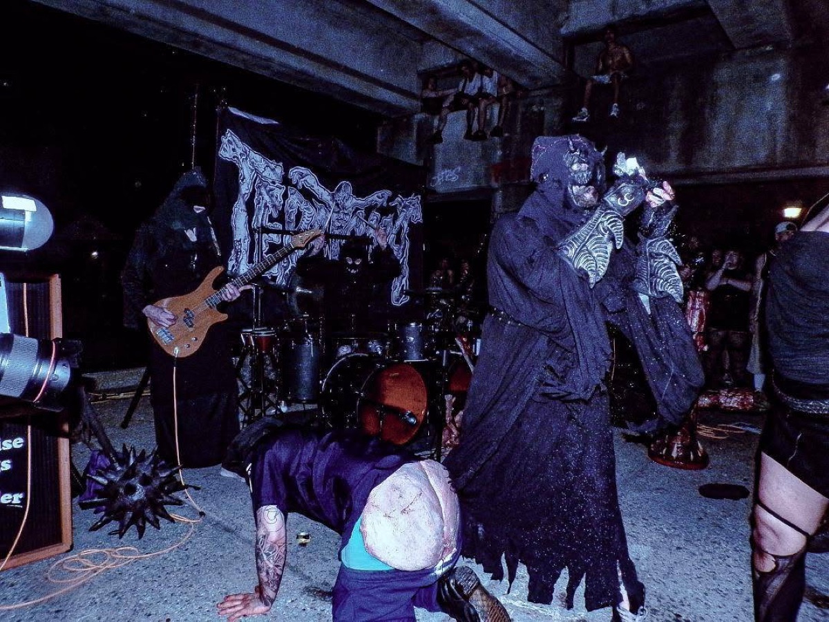 Teratoma